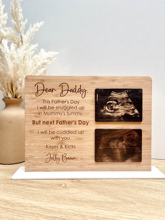 Ultrasound Photo Plaque